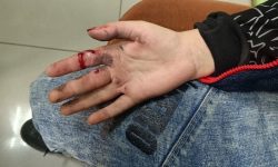 انفجار مواد محترقه در چهارشنبه‌سوری؛ پراید در خوی طعمه حریق شد