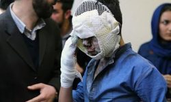 اشنویه و ارومیه در صدر آمار مصدومین چهارشنبه‌سوری